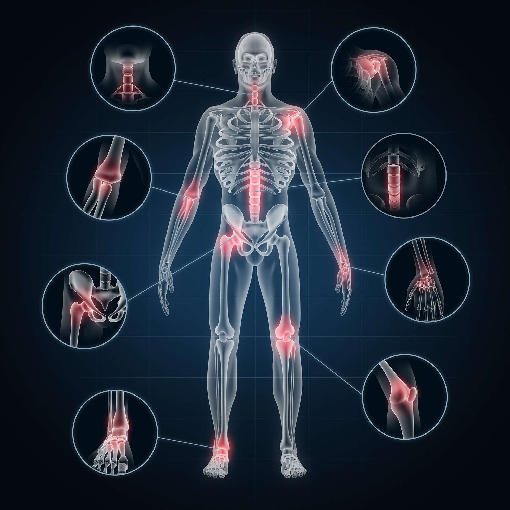 illustration of a body showing joints and bones, to represent bone density scanning at soma house in high Wycombe